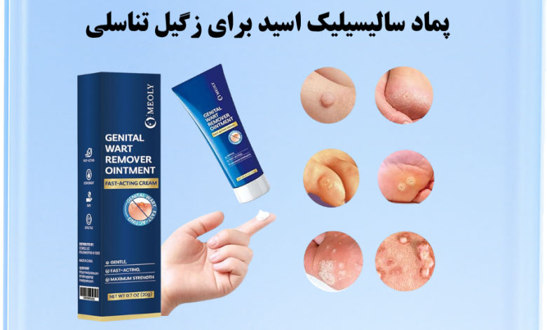 پماد سالیسیلیک اسید برای زگیل تناسلی